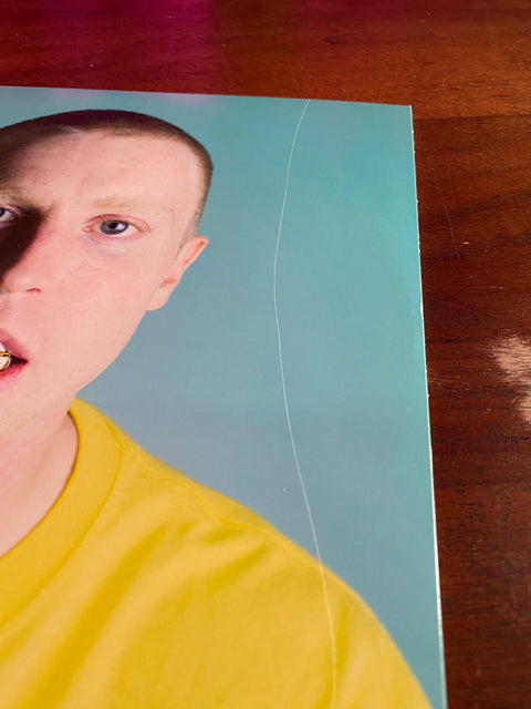 Injury Reserve - The Dentist Office Series